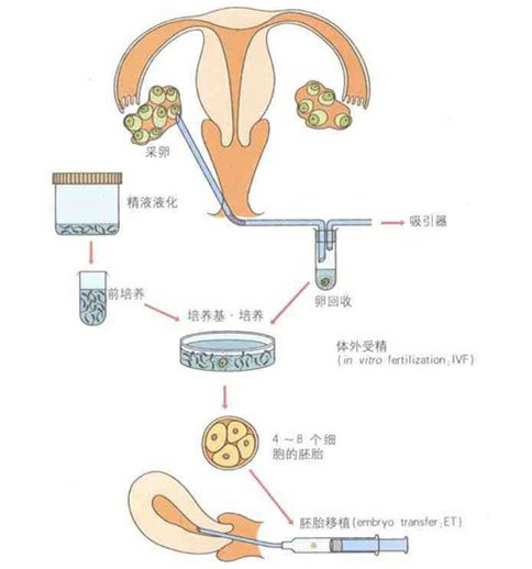 一代试管流程.jpg